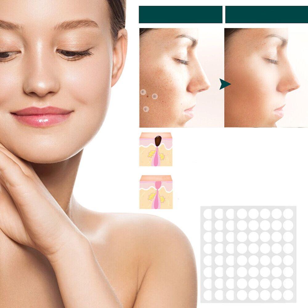 Ripob | SkinClear Hautwarzenentferner | Pflaster zur Entfernung von Hautwarzen & Warzen | Hydrocolloid-Technologie | Schmerzfrei & Diskret | Für alle Hauttypen geeignet | 144 Stück
