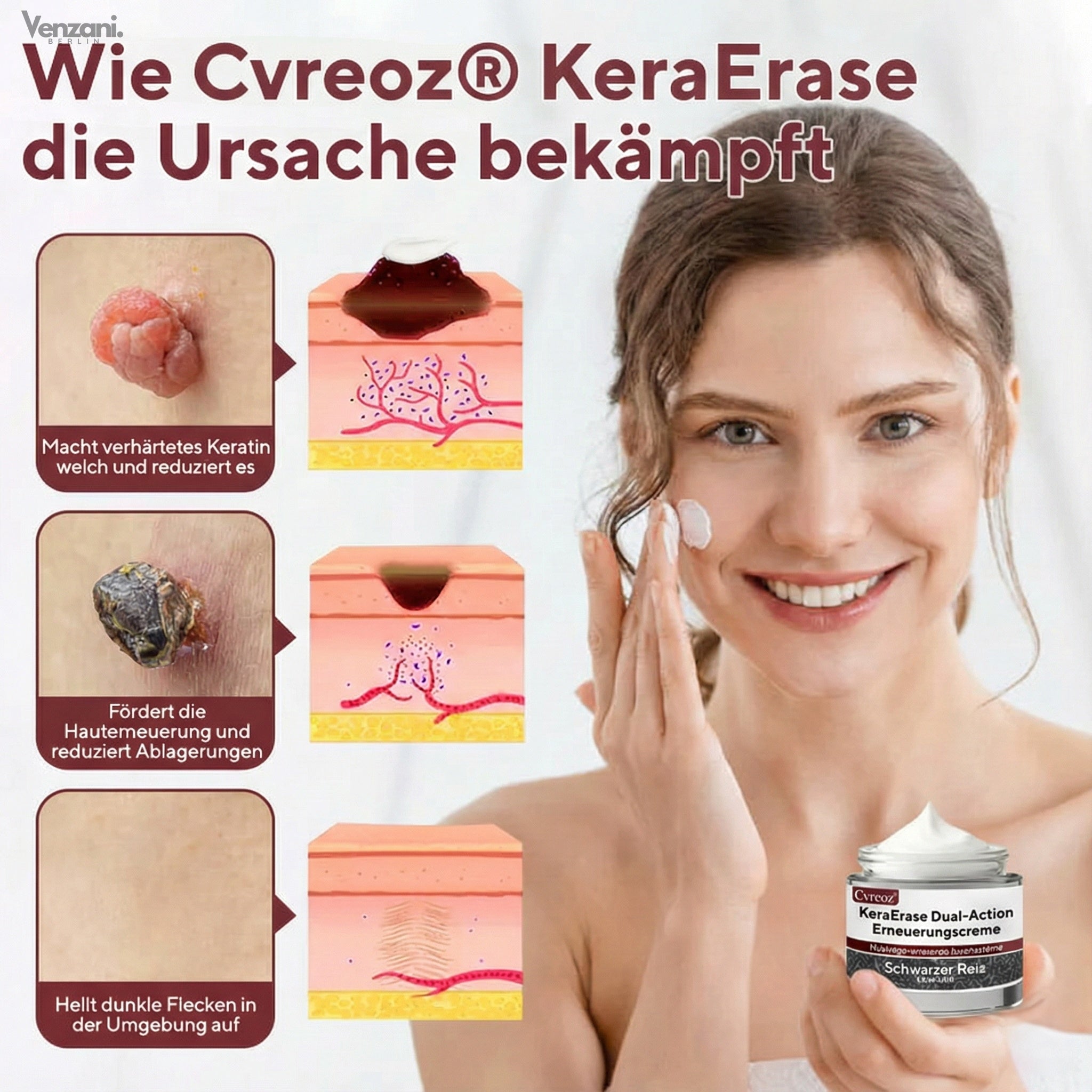 Cvreoz® KeraErase Dual-Action Renewal Cream - Die Kraft des schwarzen Reises gegen raue Stellen