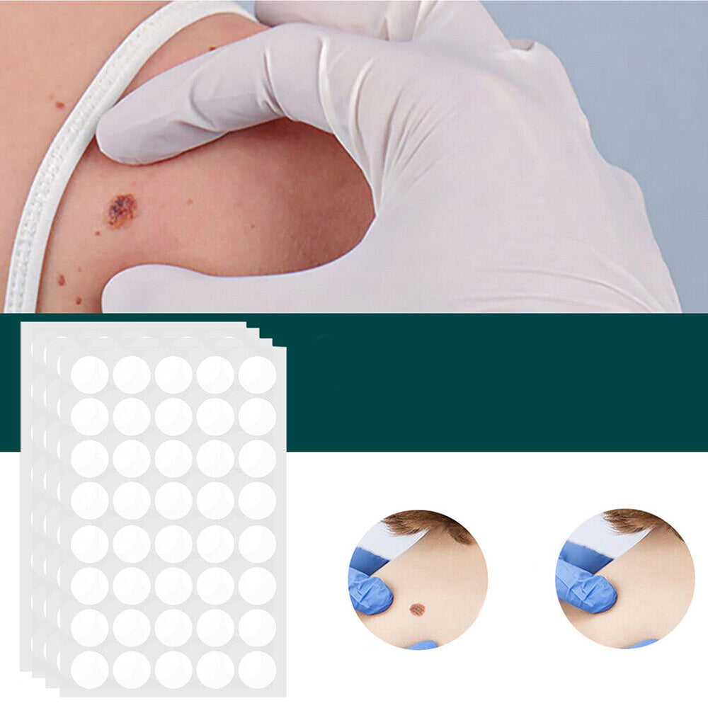 Ripob | SkinClear Hautwarzenentferner | Pflaster zur Entfernung von Hautwarzen & Warzen | Hydrocolloid-Technologie | Schmerzfrei & Diskret | Für alle Hauttypen geeignet | 144 Stück