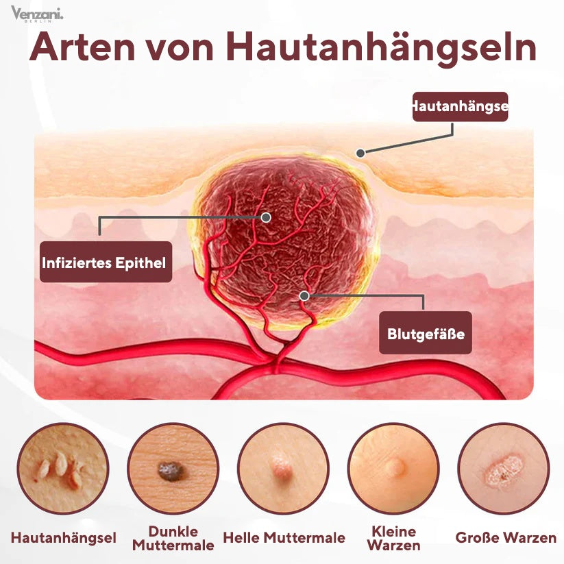 Cvreoz® KeraErase Dual-Action Renewal Cream - Die Kraft des schwarzen Reises gegen raue Stellen
